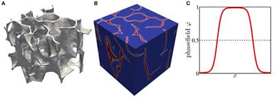 A Phase Field Approach to Trabecular Bone Remodeling